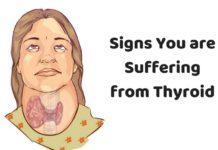 Signs You are Suffering from Thyroid