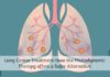 Lung Cancer Treatment-How the Photodynamic Therapy offers a Safer Alternative