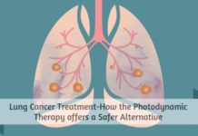 Lung Cancer Treatment-How the Photodynamic Therapy offers a Safer Alternative