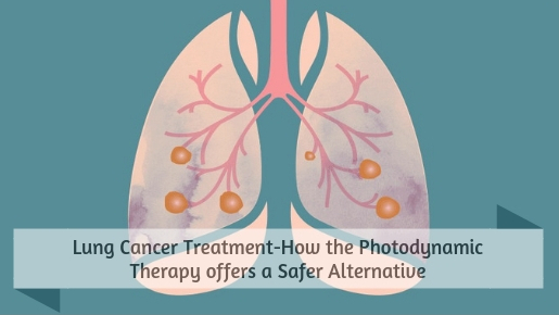 Lung Cancer Treatment-How the Photodynamic Therapy offers a Safer Alternative
