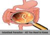 Intestinal Parasites - All You Need to Know