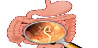 Intestinal Parasites - All You Need to Know