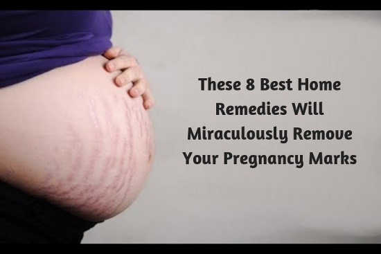 These 8 Best Home Remedies Will Miraculously Remove Your Pregnancy Marks