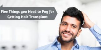 Five Things you Need to Pay for Getting Hair Transplant