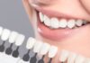 Why Do You Need to Consider Dental Implants for Missing Teeth