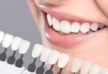 Why Do You Need to Consider Dental Implants for Missing Teeth
