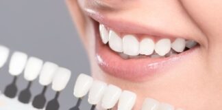 Why Do You Need to Consider Dental Implants for Missing Teeth