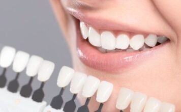 Why Do You Need to Consider Dental Implants for Missing Teeth