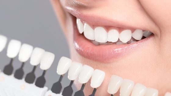 Why Do You Need to Consider Dental Implants for Missing Teeth