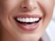 Pros & Cons of Teeth Whitening