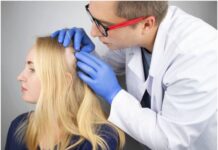 Can Alopecia be Cured Permanantly