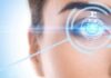 What You Need to Know About Laser Eye Surgery