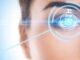 What You Need to Know About Laser Eye Surgery