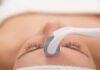 The Benefits of Micro-Needling Therapy