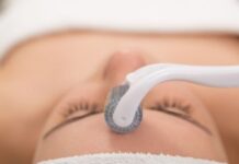 The Benefits of Micro-Needling Therapy