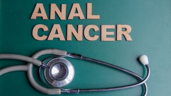 Anal Cancer - Symptoms, Causes, Prevention, and Treatment