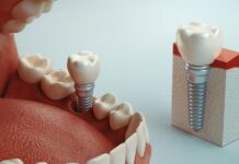 6 Mistakes To Avoid When Working With Dental Centers As Nuvia Smiles