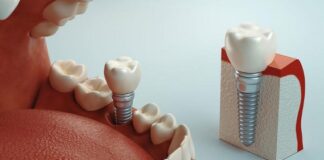 6 Mistakes To Avoid When Working With Dental Centers As Nuvia Smiles