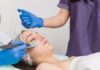 5 Things That You Need to Know About Chemical Peels