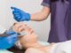 5 Things That You Need to Know About Chemical Peels