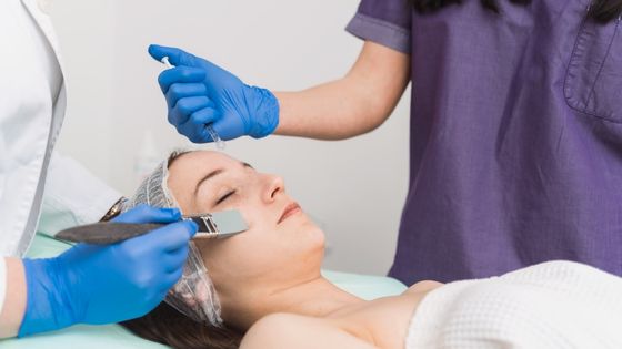 5 Things That You Need to Know About Chemical Peels