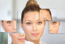 Find the Acne Medication for Your Needs