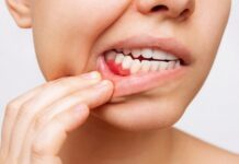 Top Tips for Preventing Gum Disease As You Age