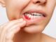 Top Tips for Preventing Gum Disease As You Age