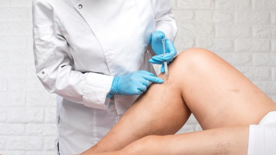 finding relief a guide to varicose vein treatment