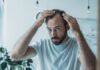 causes of hair loss and baldness in men