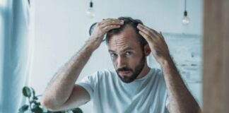 causes of hair loss and baldness in men